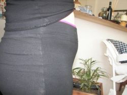 Bụng dưới lồi ra sau tạo hình thành bụng