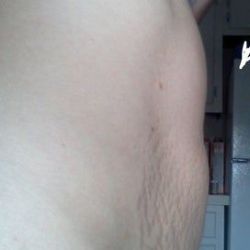 Tạo hình thành bụng nào là phù hợp với tôi?