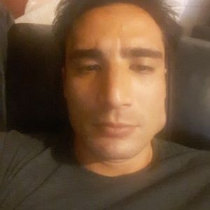 Cơ cắn góc hàm bên trái nổi cục cứng sau tiêm botox?