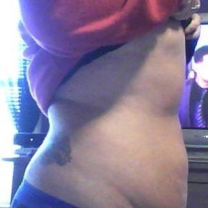 Hút mỡ có thể giúp cháu có đường cong ở bụng không?