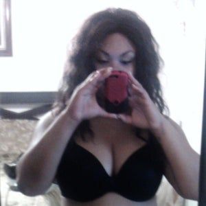 Bụng và hông quá béo – hút mỡ có tác dụng gì không?