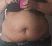 Tôi muốn làm hút mỡ thể tích lớn, không mong thon gọn, chỉ mong giảm được khối lượng phù hợp với thực tế. Mong các bác sĩ cho lời khuyên. Tôi muốn làm hút mỡ thể tích lớn, không mong thon gọn, chỉ mong giảm được khối lượng phù hợp với thực tế. Mong các bác sĩ cho lời khuyên.