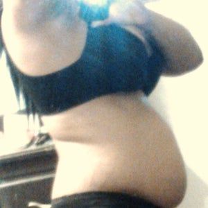 Bụng và hông quá béo – hút mỡ có tác dụng gì không?