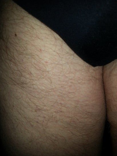 Tôi cần thu gọn 30kg trên cơ thể, hút mỡ có giúp tôi không? Tôi cần thu gọn 30kg trên cơ thể, hút mỡ có giúp tôi không?