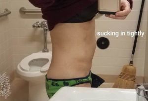 Hút mỡ ThermaLipo có chữa được tách cơ bụng cho bệnh nhân gầy không?