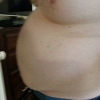 Tôi cần thu gọn 30kg trên cơ thể, hút mỡ có giúp tôi không? Tôi cần thu gọn 30kg trên cơ thể, hút mỡ có giúp tôi không?