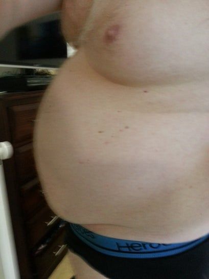 Tôi cần thu gọn 30kg trên cơ thể, hút mỡ có giúp tôi không? Tôi cần thu gọn 30kg trên cơ thể, hút mỡ có giúp tôi không?