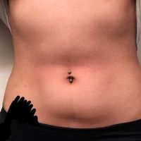 Tôi khá gầy thì nên chọn hút mỡ hay tiếp tục làm đông hủy mỡ CoolSculpting? Tôi khá gầy thì nên chọn hút mỡ hay tiếp tục làm đông hủy mỡ CoolSculpting?