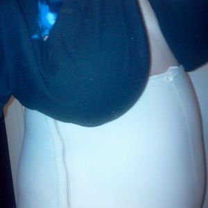 Đau, sưng nề, co rút cơ bụng sau 2 tuần từ khi làm tạo hình thành bụng. Có bình thường không?