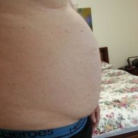 Tôi cần thu gọn 30kg trên cơ thể, hút mỡ có giúp tôi không? Tôi cần thu gọn 30kg trên cơ thể, hút mỡ có giúp tôi không?