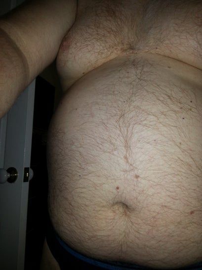 Tôi cần thu gọn 30kg trên cơ thể, hút mỡ có giúp tôi không? Tôi cần thu gọn 30kg trên cơ thể, hút mỡ có giúp tôi không?