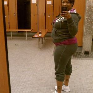 Mỗi lần hút mỡ loại bỏ được tối đa bao nhiêu lít mỡ, có cần chia làm hai lần không?