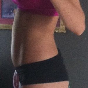 Hút mỡ cho bệnh nhân vốn đã gầy và chỉ có ít mỡ ở bụng?