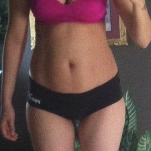 Hút mỡ cho bệnh nhân vốn đã gầy và chỉ có ít mỡ ở bụng?