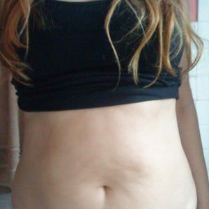 Bao lâu sau hút mỡ thì có thể mang thai?