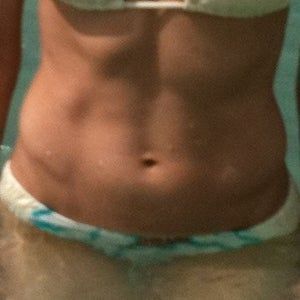 Bị béo hông hay là biến dạng cơ bụng?