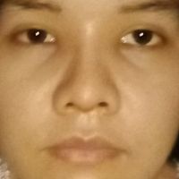 Lộ sóng mũi Lộ sóng mũi