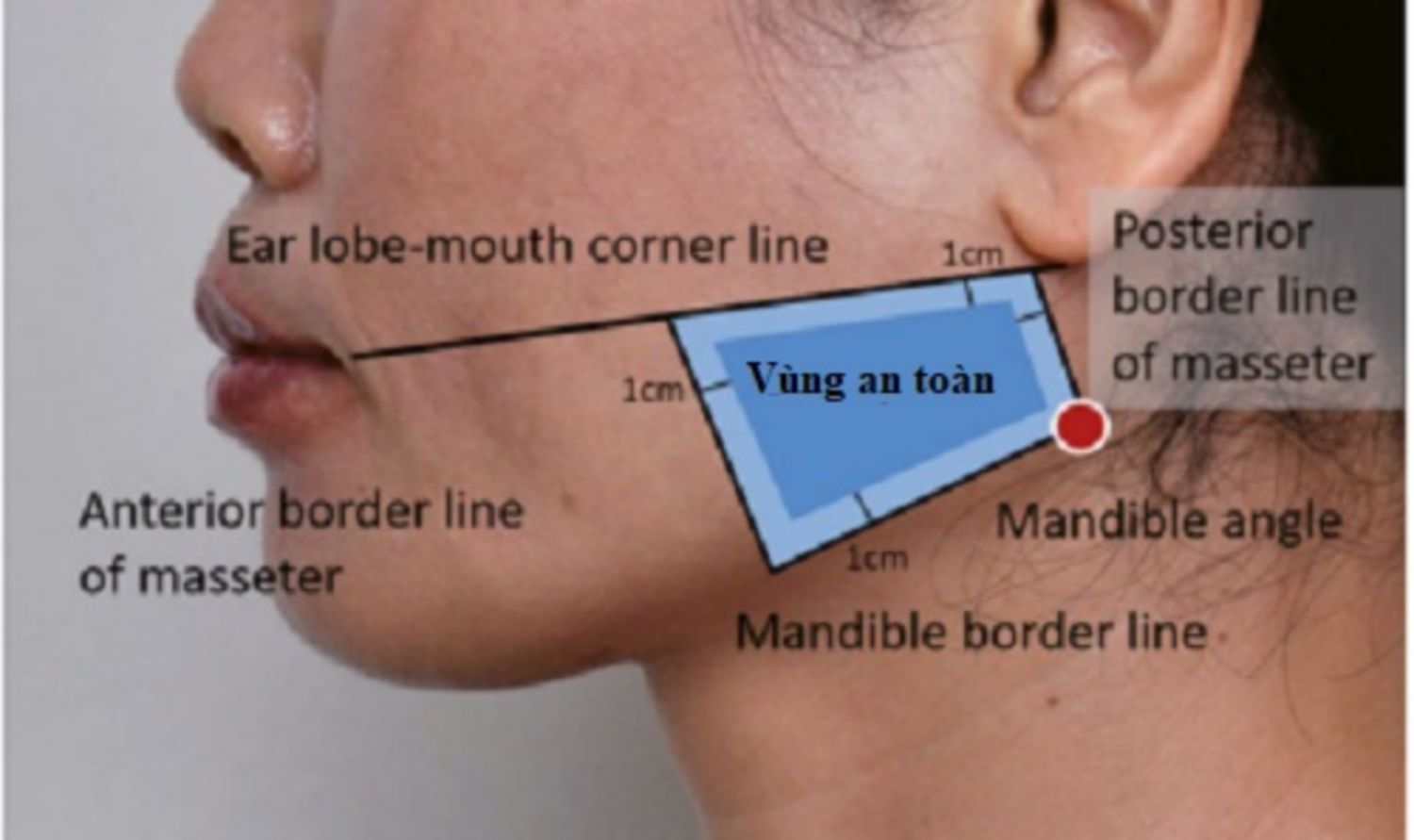 vùng tiêm an toàn