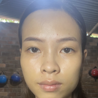 Căng da mặt bằng chỉ có cải thiện được tình trạng mặt lệch không? Căng da mặt bằng chỉ có cải thiện được tình trạng mặt lệch không?