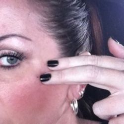 Điều gi xảy ra khi botox được tiêm vào vị trí trên má như thế này?