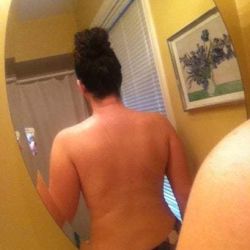 Sưng nề giao động liên tục trong 6 tuần kể từ khi hút mỡ lưng