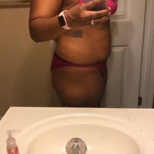 Tôi cao 1m73, nặng 90,7 kg, đã có 1 con. Tôi có phù hợp làm hút mỡ bụng/lườn không?