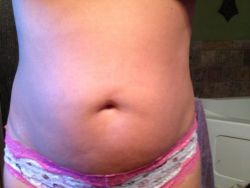 Không sưng nề hay bầm tím rõ rệt sau hút mỡ sóng siêu âm 3 ngày, như thế có bình thường không?