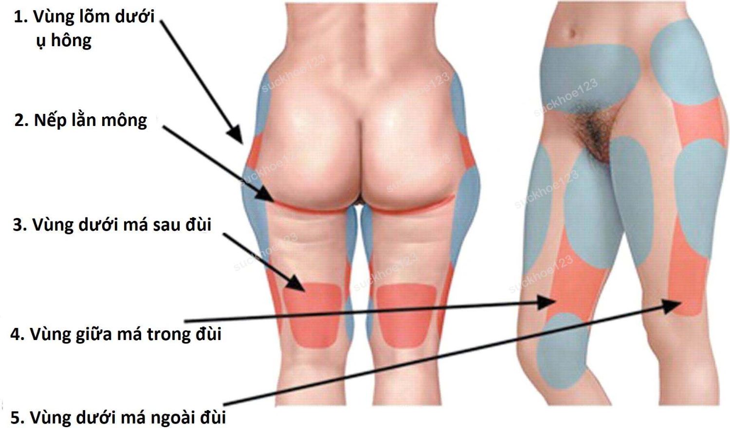 cac vung mo dui