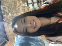 Căng da mặt bằng chỉ có cải thiện được tình trạng mặt lệch không? Căng da mặt bằng chỉ có cải thiện được tình trạng mặt lệch không?