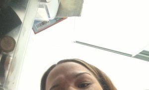 Đã 3 tháng sau khi tiêm Dysport vào trán nhưng vẫn còn cục u lớn trên trán???