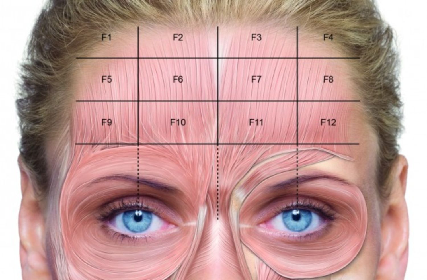 19 jul 2017 figure 190