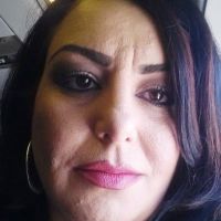 Tiêm tổng cộng 65 unit dysport nhưng vẫn có thể hoạt động, co hoặc nhíu mày rất mạnh, nếp cau mày vẫn còn rõ