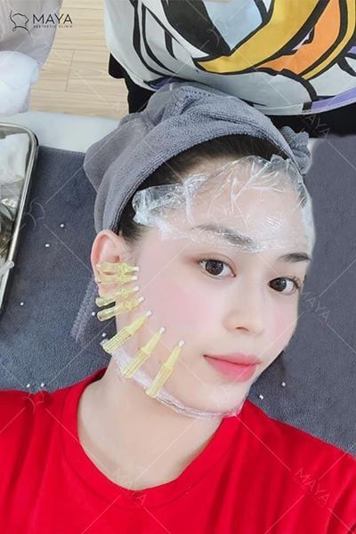 BÁC SĨ  LONG CHIA SẺ: NÊN HAY KHÔNG NÊN CĂNG CHỈ ???