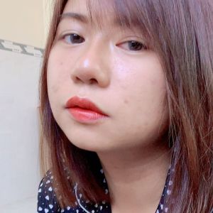 Nâng mũi Gore-tex + bọc sụn tai được 1 tháng, đầu mũi cứng và có càm giác căng tức hàm trên