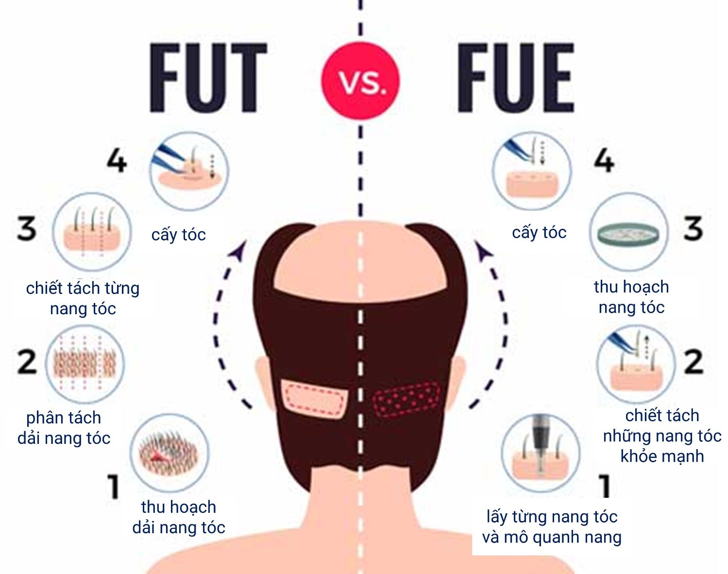 cay toc fue va fut (1)