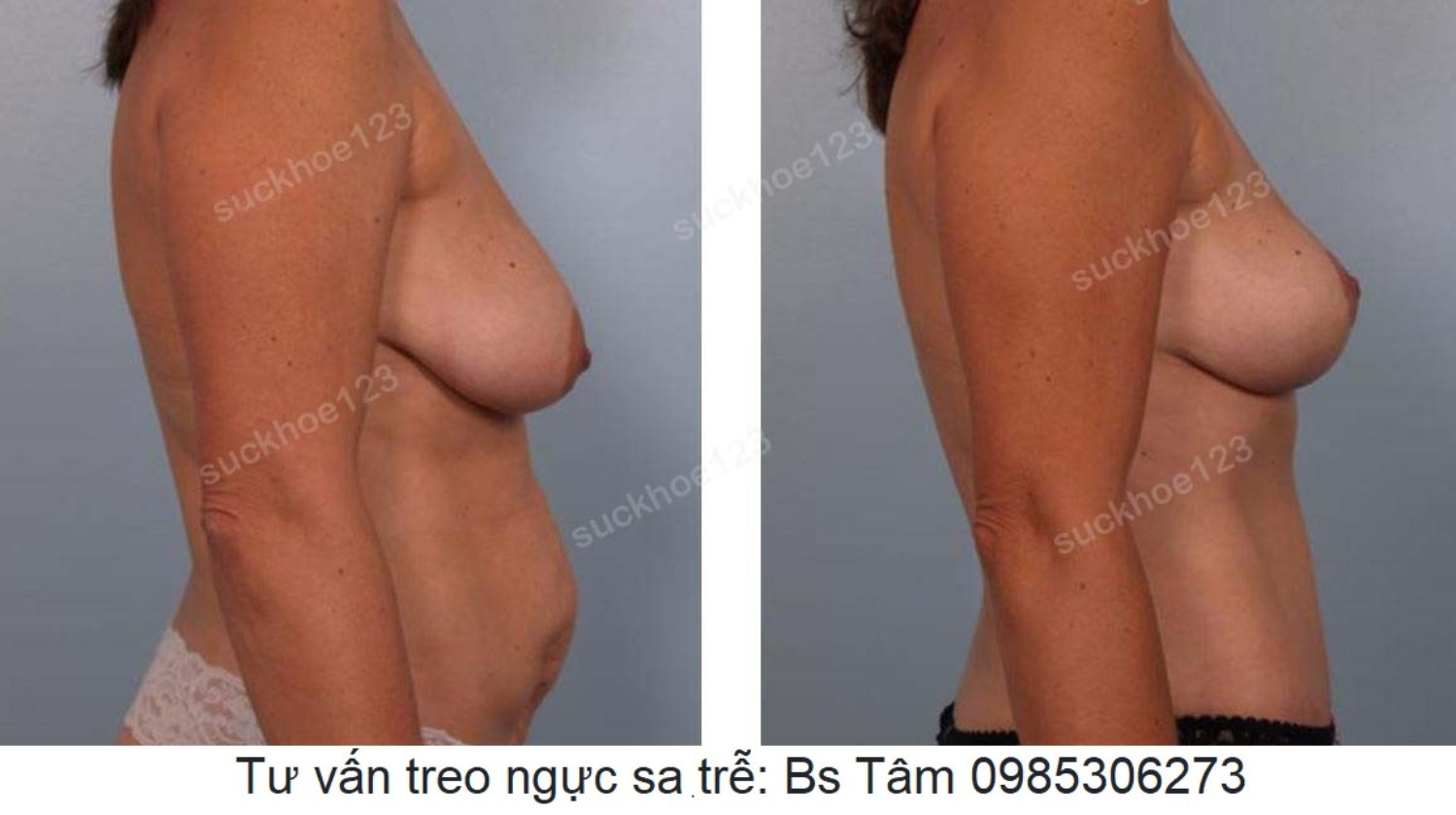 treo sa tre dat tui don ca 34 2