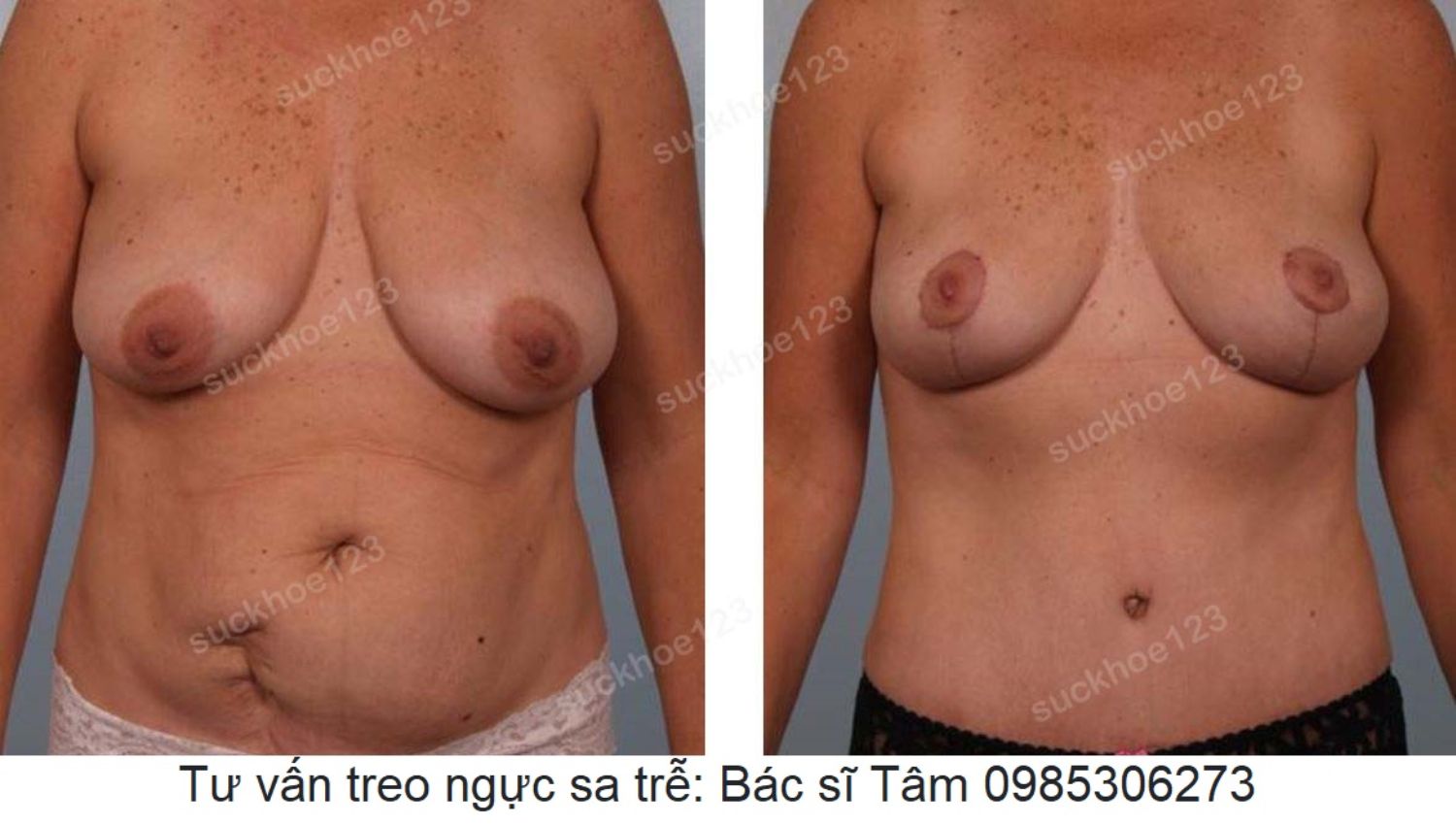 treo sa tre dat tui don ca 34