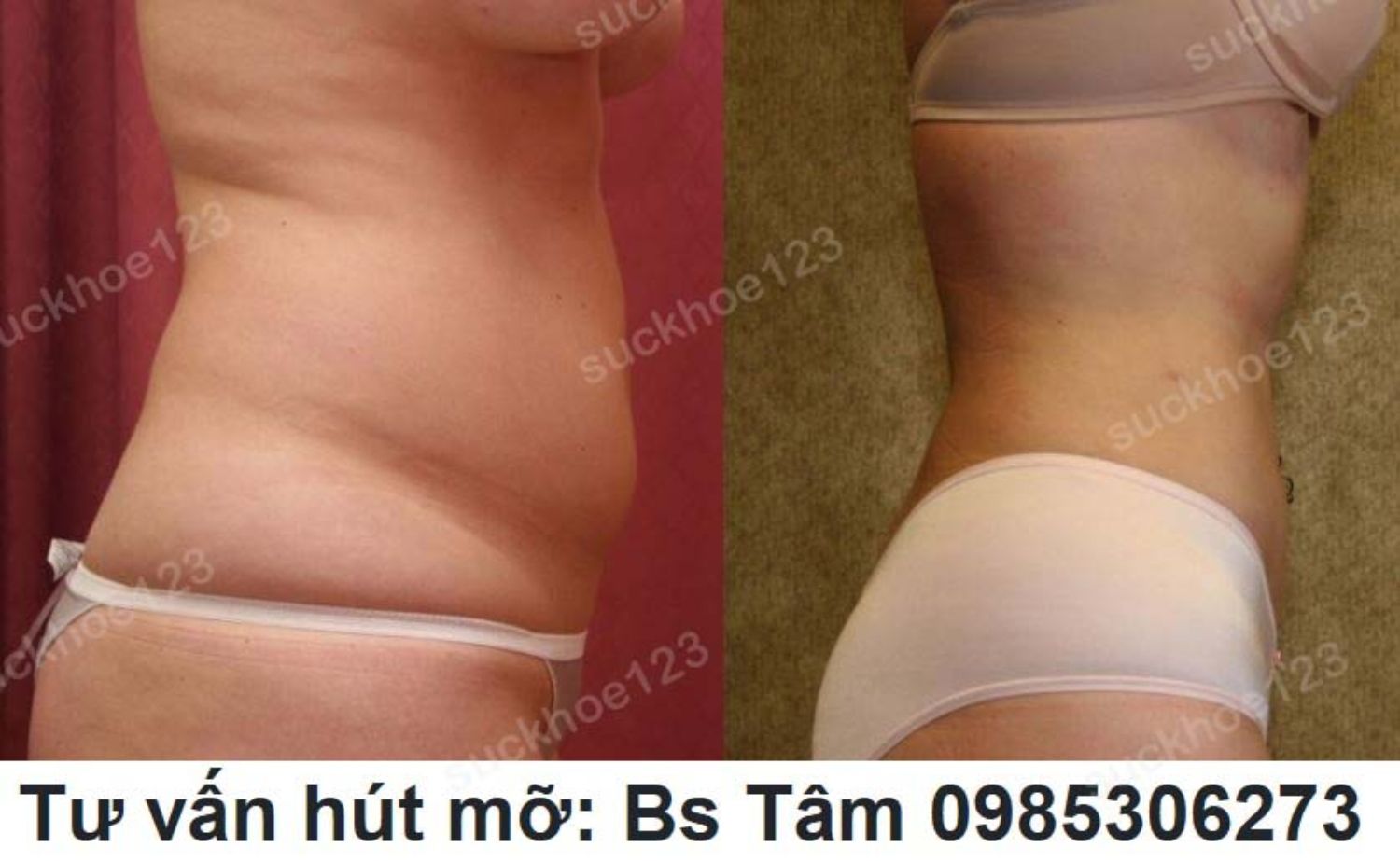 hut mo bac si tam ca 12 1