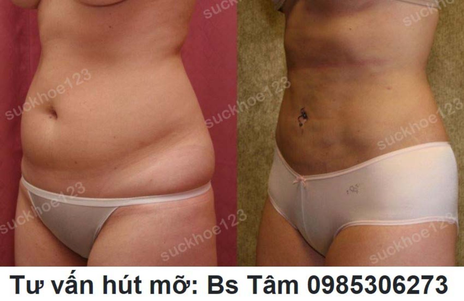 hut mo bac si tam ca 12 2
