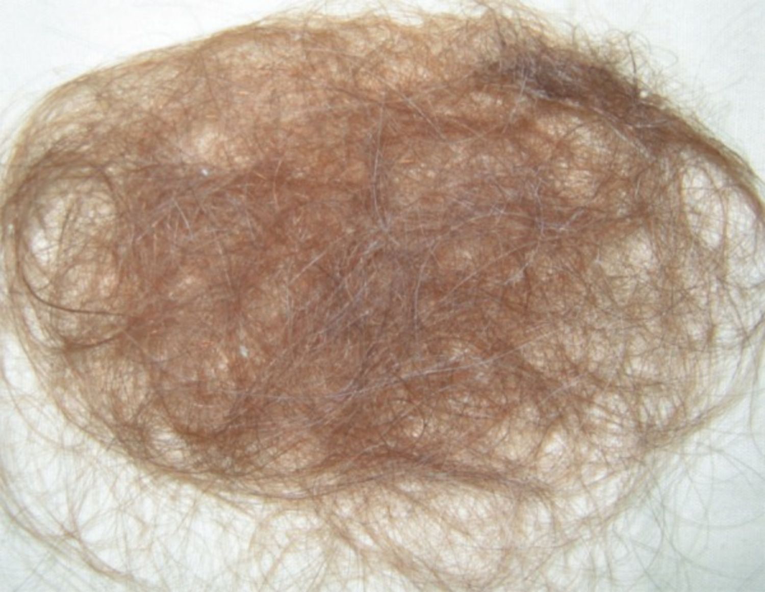 mẫu rụng tóc Telogen