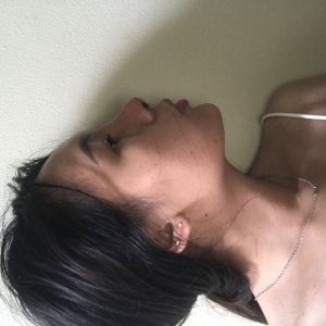 Sống mũi ở hốc mắt có gom thấp xuống không