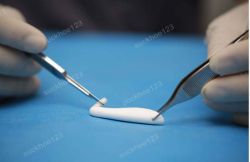 Nâng mũi giá bao nhiêu tiền? Đăng ký trợ giá nâng mũi tại các bệnh viện, thẩm mỹ viện uy tín