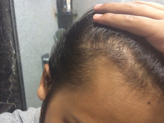 10 nguyên nhân hàng đầu gây ra rụng tóc ở nam giới  ELLE Man