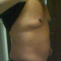 Nam giới muốn giảm mỡ bụng, ngực có nên làm đông hủy mỡ?