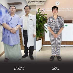 Phẫu thuật giảm cân, nam 18 tuổi, 127 kg - ca 1