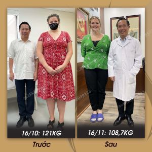 Phẫu thuật giảm cân, phụ nữ Tây 35 tuổi, 121 kg - ca 22