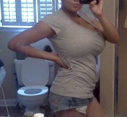 Tôi 17 tuổi, mặc áo bra thì ngực to cỡ 32J, cao 1m6 và nặng 63 kg. Tôi có đủ điều kiện để làm thu nhỏ vú không?