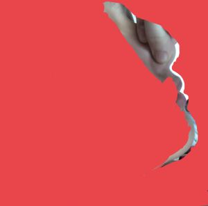 Da mũi mỏng, sống mũi rất thấp (gần như không có) thì phải nâng mũi thế nào?