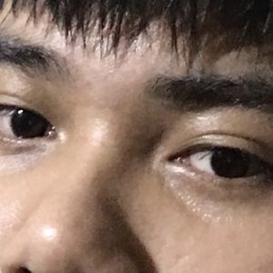 cho em hỏi đây là bị gì ạ