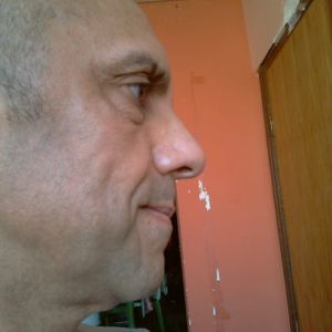 Tôi nên xử lý mặt chảy xệ ở tuổi 48 như thế nào?